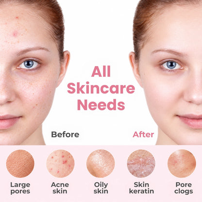 Facial Cleansing Brush PRO